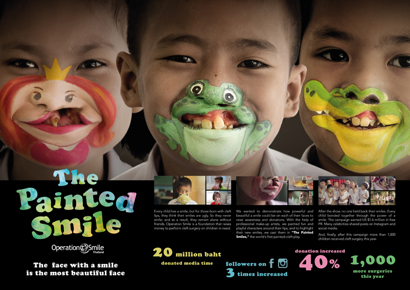 Operation Smile 微笑行动